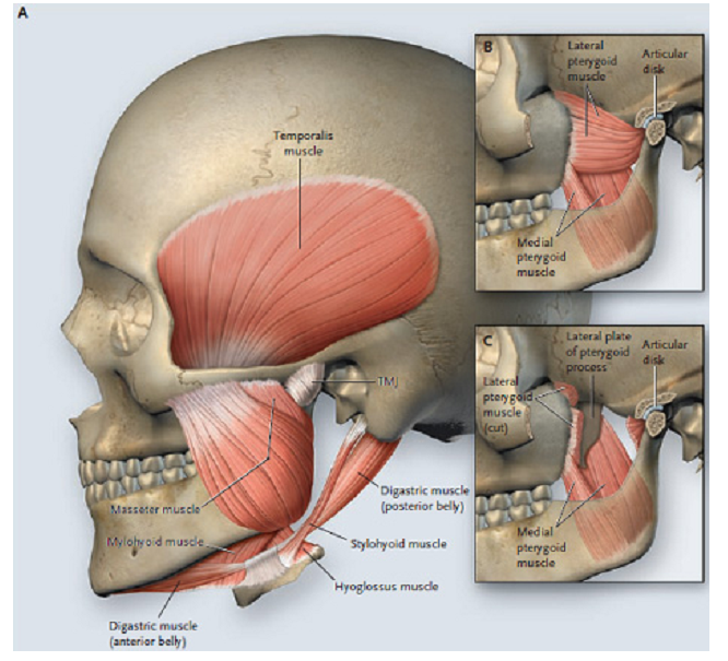측두하악장애(TMD)의 이해 해부 및 운동 네이버 블로그