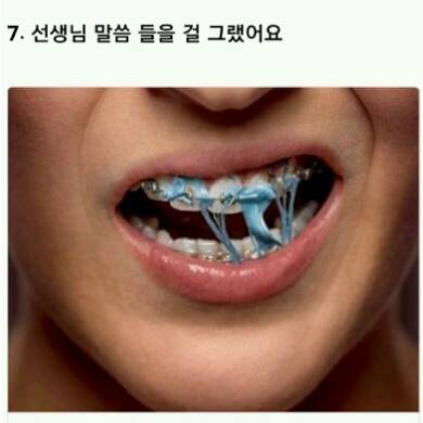 치아교정의 고통 ㄷㄷㄷ.jpg | 인스티즈